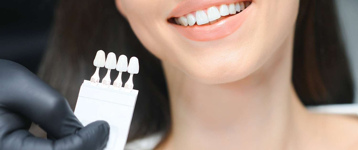 Impianti dentali e protesi: soluzioni avanzate per un sorriso completo