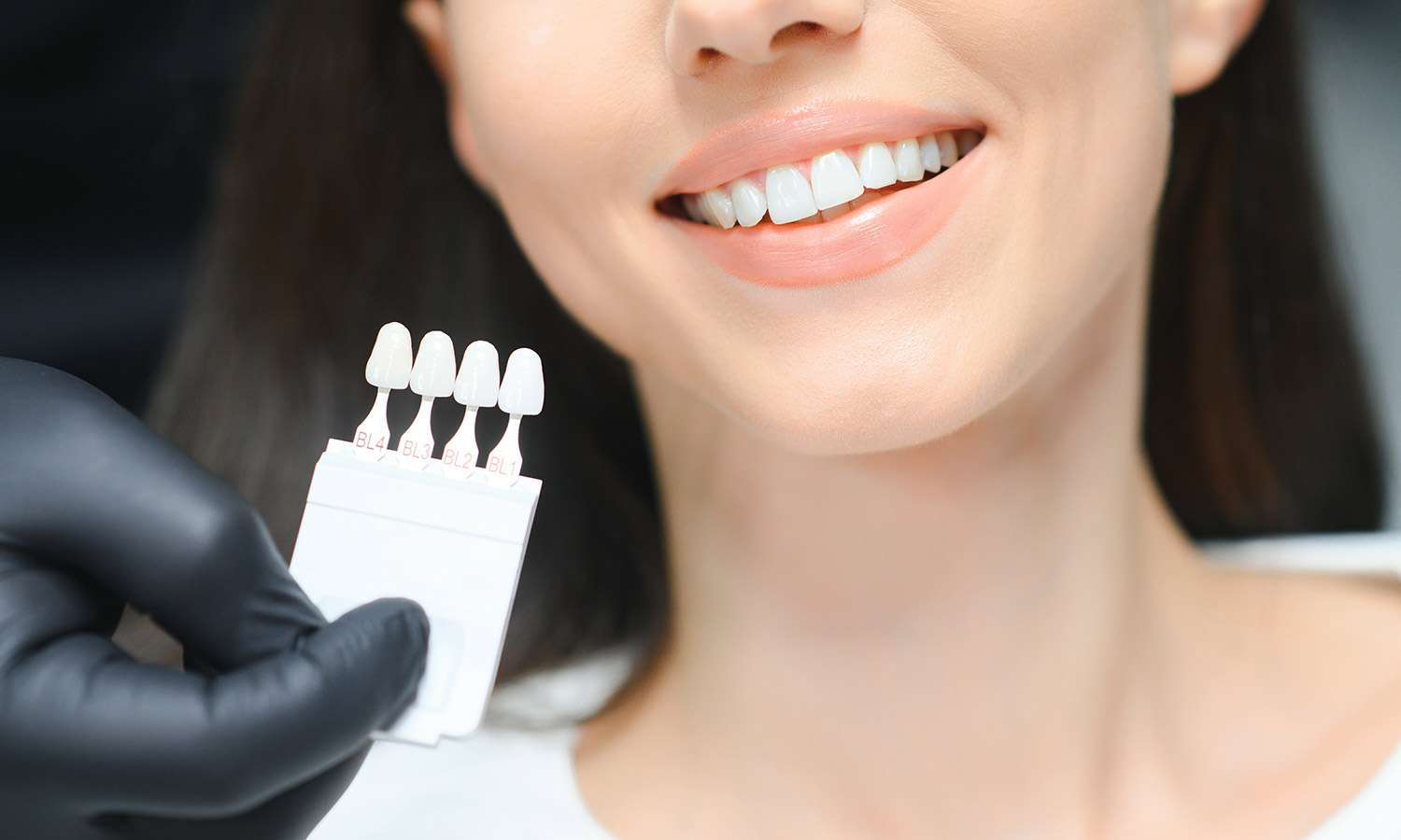 Impianti dentali e protesi: soluzioni avanzate per un sorriso completo Impianti dentali e protesi: soluzioni avanzate per un sorriso completo