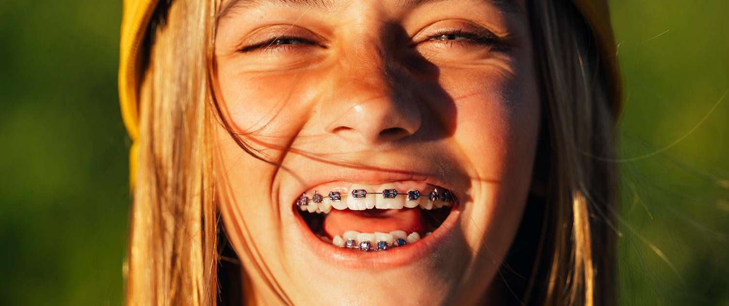 Ortodonzia e apparecchi ortodontici