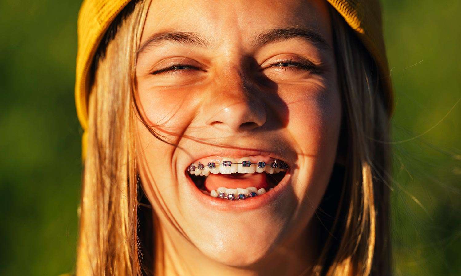 Ortodonzia e apparecchi ortodontici Ortodonzia e apparecchi ortodontici