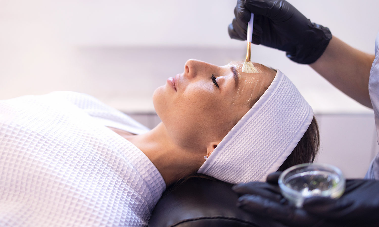 Peeling chimico: La soluzione per una pelle nuova, elastica e luminosa