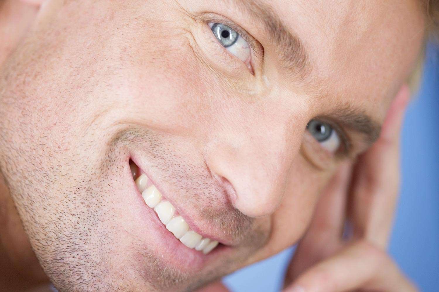 Filler rughe naso-labiali e della marionetta